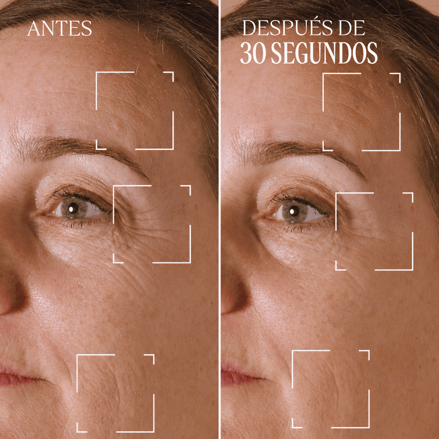 Tratamiento para Arrugas Localizadas Immortelle Divina Normal BLOC40672 